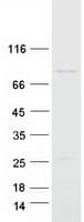 Human TOX Protein (Recombinant Myc-DDK (Flag))