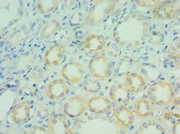 BCL7C Antibody (aa58-217)
