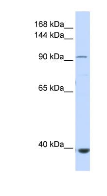 IFIH1 / MDA5 Antibody (aa612-661)