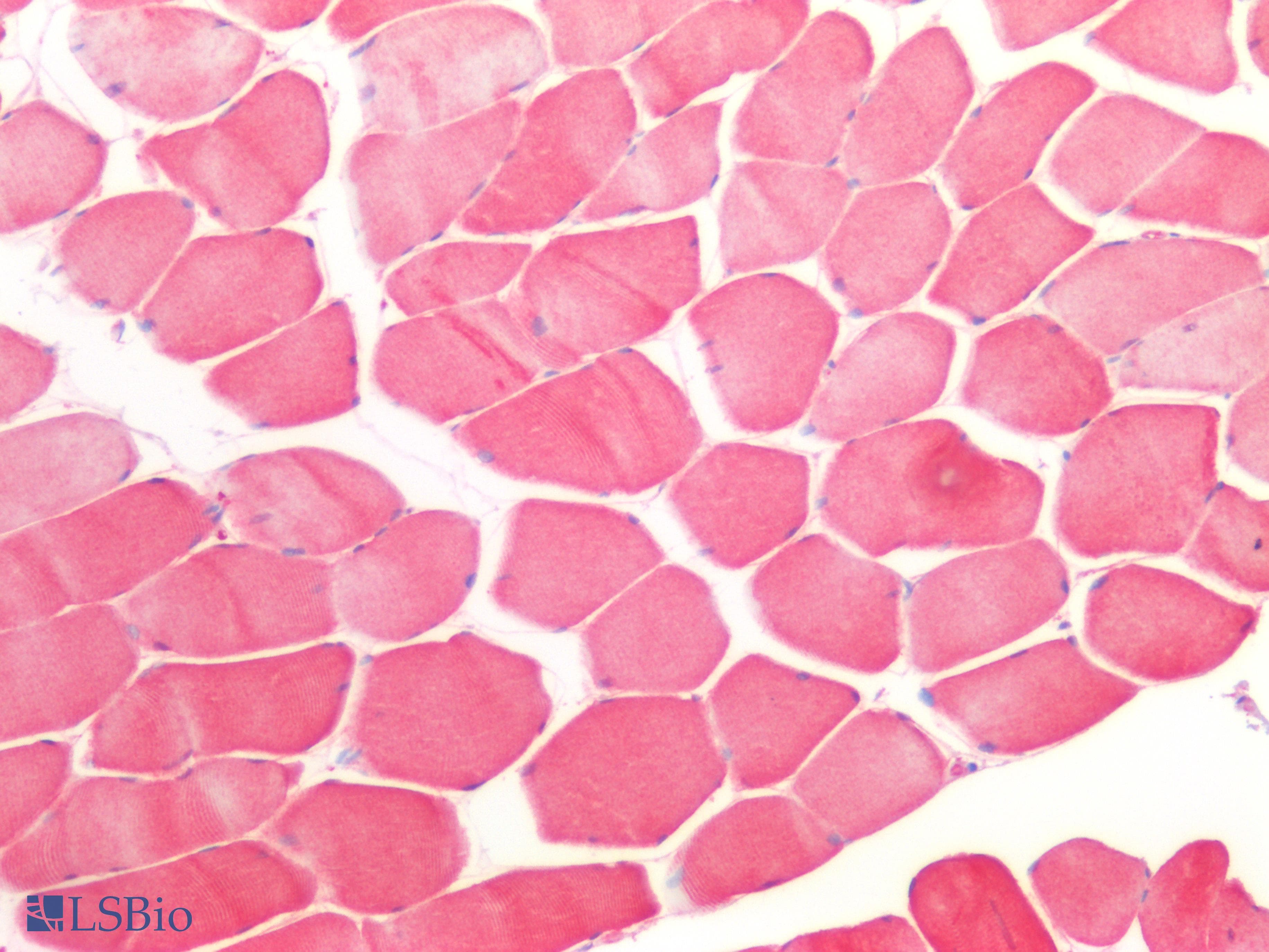 PathPlus™ Polyclonal Rabbit anti-Human CFL2 / Cofilin 2 Antibody (IHC, IF, WB)