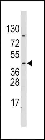 PDK4 Antibody (aa250-277)