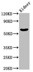 GNT-III / MGAT3 Antibody