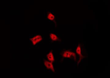 BRMS1 Antibody