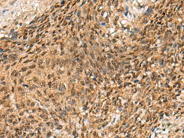 CRCP / CGRP Receptor Component Antibody