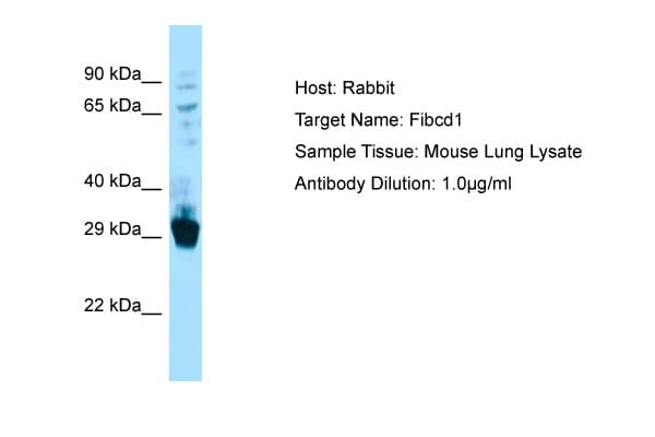 Polyclonal Rabbit anti-Mouse FIBCD1 Antibody (C-Terminus, WB)