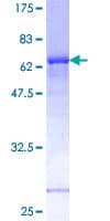 Human FRA-1 / FOSL1 Protein (Recombinant GST)