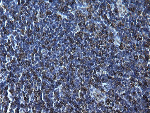CD74 / CLIP Antibody (clone OTI1H3)