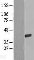 FRG1 Protein (Over-Expression Lysate Myc-DDK (Flag))