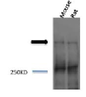 Polyclonal Rabbit anti-Human Piccolo Antibody (IHC, WB)