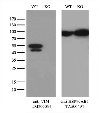 Monoclonal Mouse anti-Human Vimentin Antibody (clone UMAB159, Carrier-free, aa210-466, IHC, IF, WB)