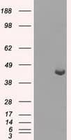PME-1 / PPME1 Antibody (clone OTI10B2)