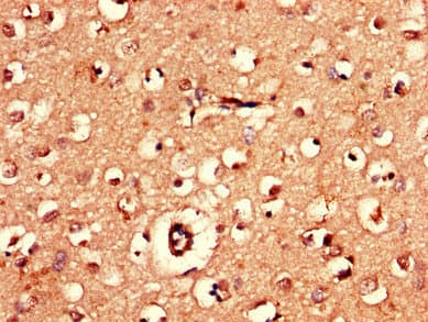 Polyclonal Rabbit anti-Human AK5 / Adenylate Kinase 5 Antibody (IHC, IF, WB)