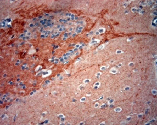 GAD 65+67 Antibody (aa530-600)