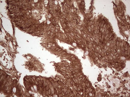 UBE2D2 / UBCH5B Antibody (clone OTI1D11)