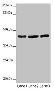 Polyclonal Rabbit anti-Human MTERF4 / MTERFD2 Antibody (IHC, IF, WB)