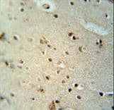 Polyclonal Rabbit anti-Human Capicua / CIC Antibody (aa174-203, IHC, WB)