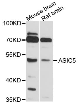 ACCN5 / HINAC Antibody