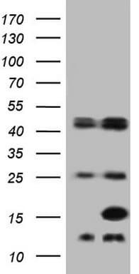 E-FABP / FABP5 Antibody (C-Terminus)