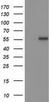 TP53 / p53 Antibody (clone OTI2H4)