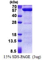 Human PPM1F Protein (Recombinant His)