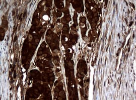 NME1 / NM23 Antibody (clone OTI4H2)