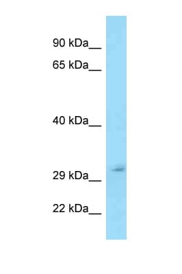 TFPI / LACI Antibody (aa119-168)