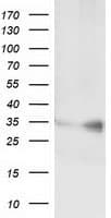 C21orf59 Antibody (clone OTI1F1)