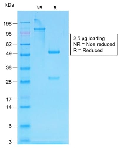 IgG Heavy Chain Antibody (clone IG507R)