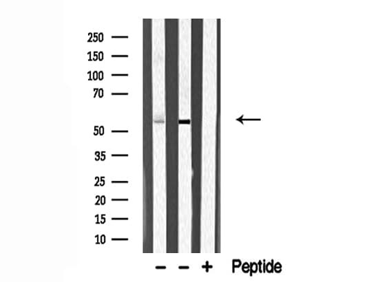 SKIL / SNO / SnoN Antibody