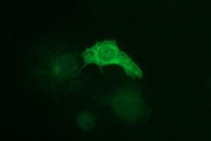 TUBB1 / Tubulin Beta 1 Antibody (clone OTI1D5)