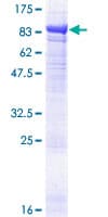 Human EPM2AIP1 Protein (Recombinant GST)