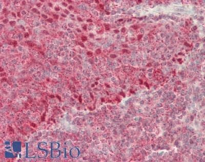 PSIP1 / LEDGF Antibody (aa311-360)