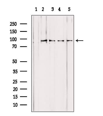 PYGL Antibody