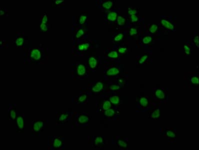 HIST1H2AI Antibody