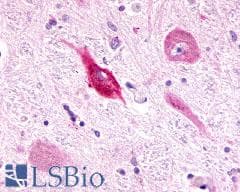 PathPlus™ ADGRL3 / LPHN3 Antibody (C-Terminus)