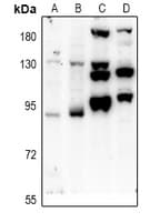 PTPN22 / PEP Antibody