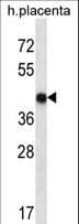 OR10V1 Antibody (aa281-309)