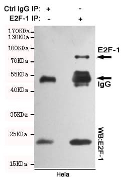 E2F1 Antibody