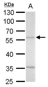 IHC-plus™ AZIN2 / Antizyme Inhibitor 2 Antibody (Internal)