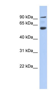 ACAP3 Antibody (aa107-156)