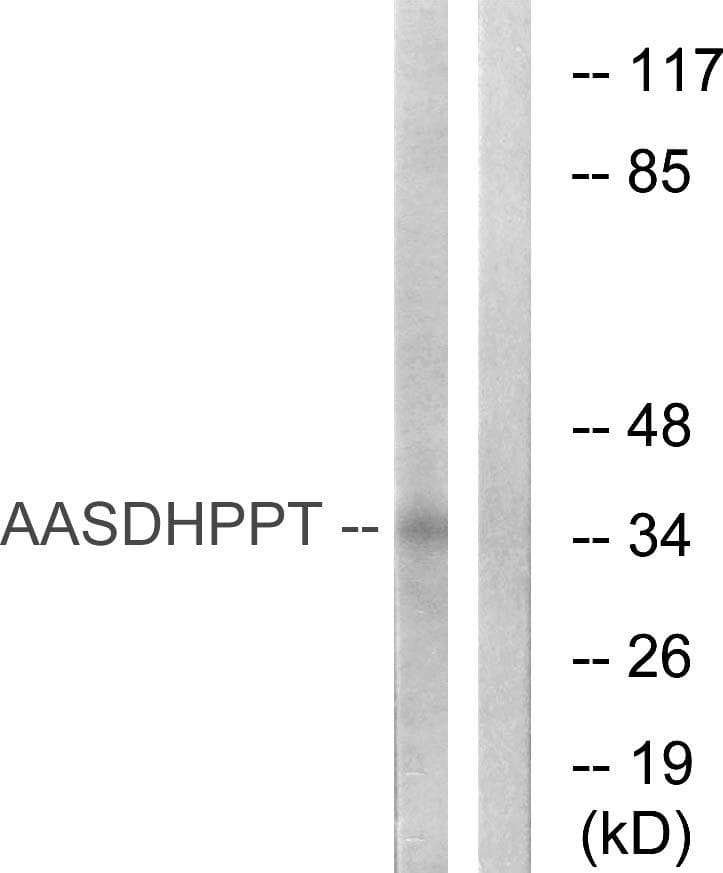Polyclonal Rabbit anti-Human AASDHPPT / LYS5 Antibody (WB)