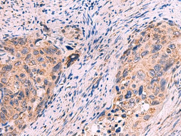 KCNN1 Antibody