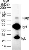 IKBKB / IKK2 / IKK Beta Antibody (clone 10A9B6)
