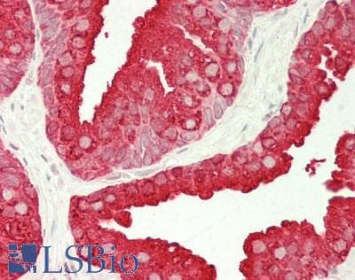 IHC-plus™ ACPP / PAP Antibody (aa 38-386)