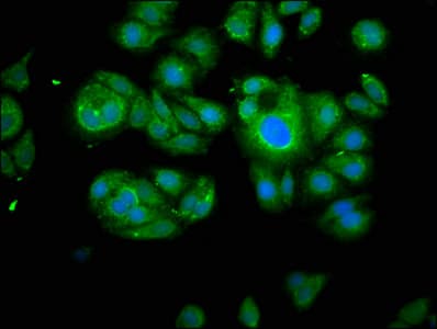 IHC-plus™ CAPN2 / Calpain 2 / M-Calpain Antibody