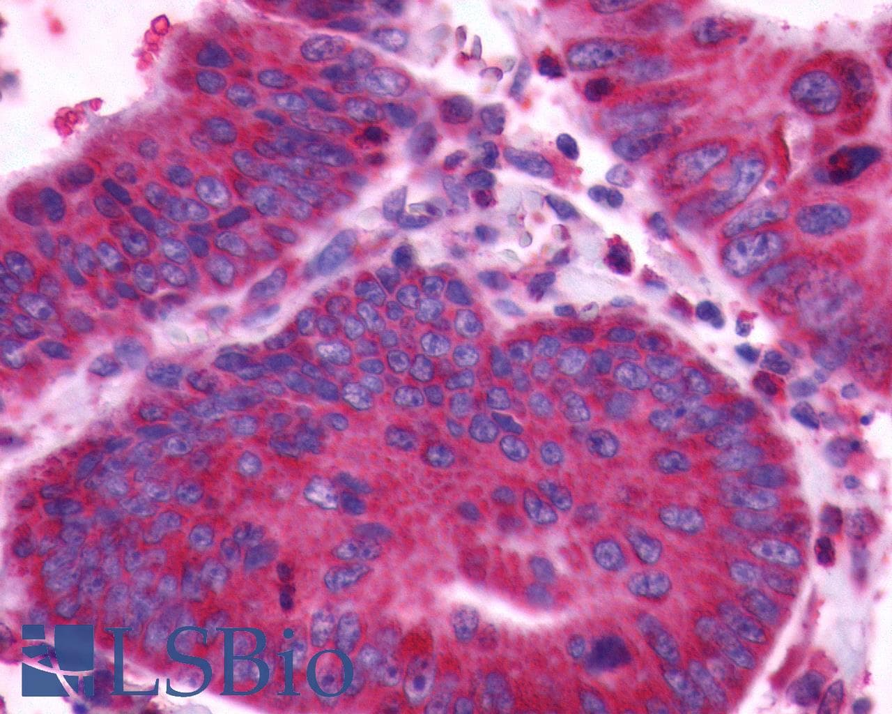 PathPlus™ CXCR4 Antibody (Cytoplasmic Domain)