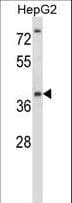 Polyclonal Rabbit anti-Human NANOS1 / NOS1 Antibody (aa96-124, IHC, WB)
