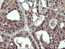 PPAT Antibody (aa42-278, clone OTI1B11)