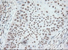 NOG / Noggin Antibody (clone OTI1C1)