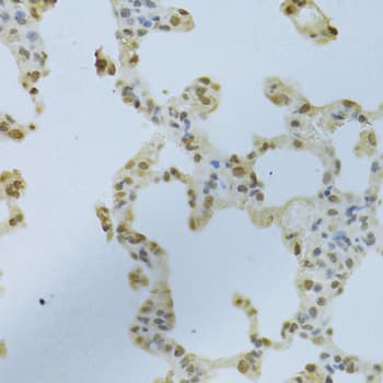 Polyclonal Rabbit anti-Human HNRNPK / hnRNP K Antibody (IHC, IF, WB)